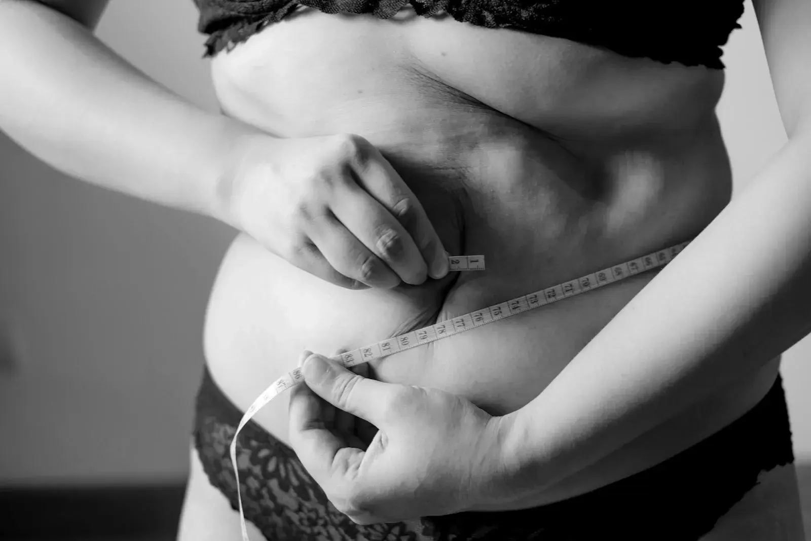 HIFU vs. Cavitación para grasa abdominal: cuál elegir